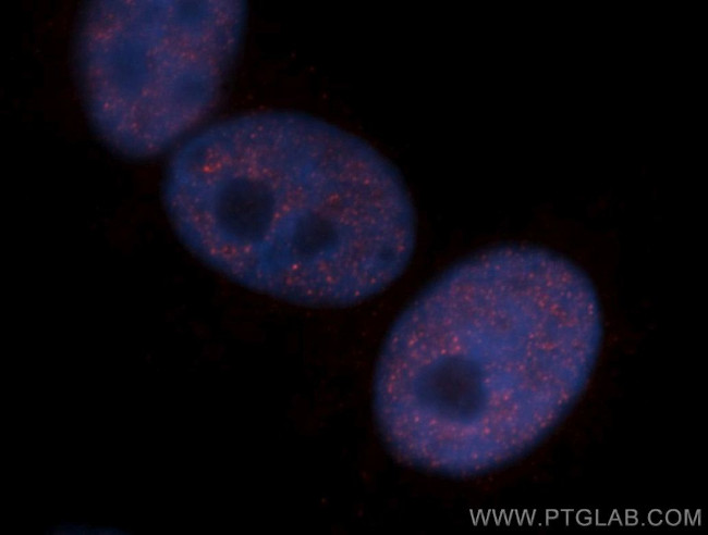 CHD4 Antibody in Immunocytochemistry (ICC/IF)