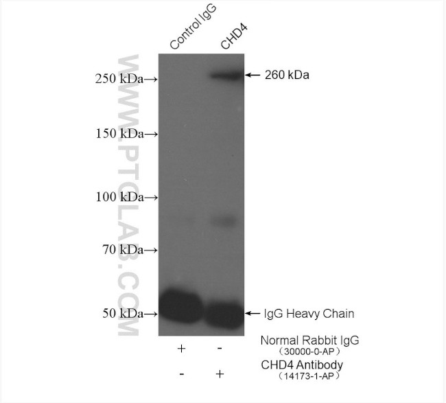 CHD4 Antibody in Immunoprecipitation (IP)