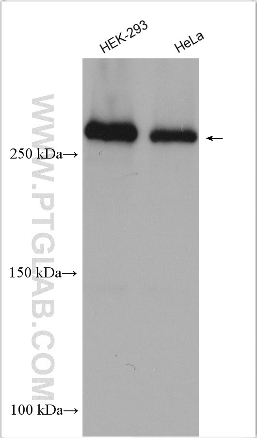 CHD4 Antibody in Western Blot (WB)