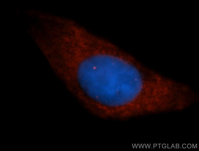 Liprin alpha 1 Antibody in Immunocytochemistry (ICC/IF)