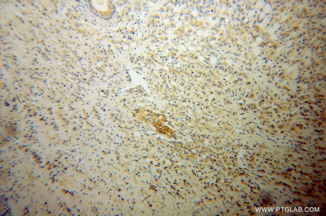 Liprin alpha 1 Antibody in Immunohistochemistry (Paraffin) (IHC (P))