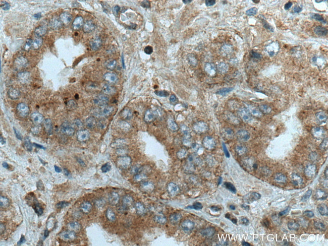 Liprin alpha 1 Antibody in Immunohistochemistry (Paraffin) (IHC (P))