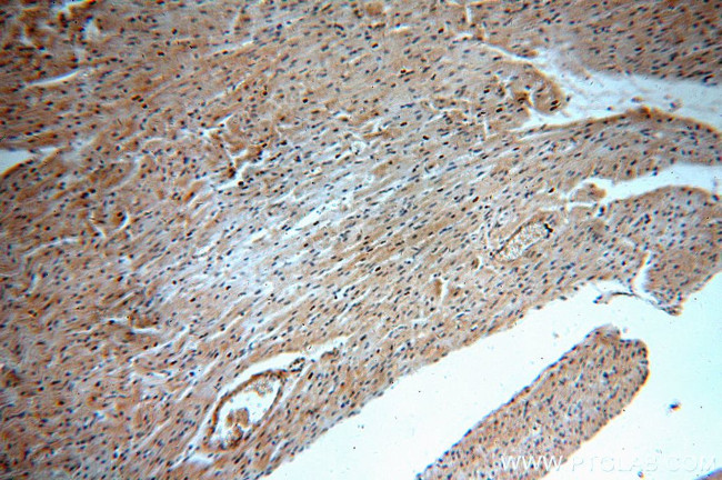 B3GALT2 Antibody in Immunohistochemistry (Paraffin) (IHC (P))