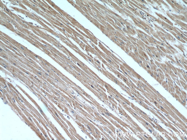 B3GALT2 Antibody in Immunohistochemistry (Paraffin) (IHC (P))