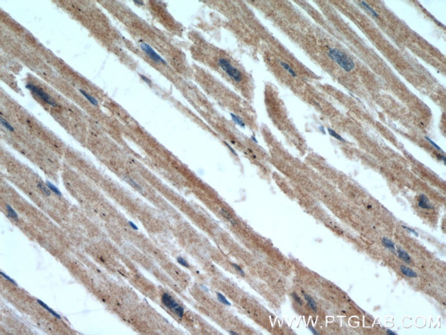 B3GALT2 Antibody in Immunohistochemistry (Paraffin) (IHC (P))