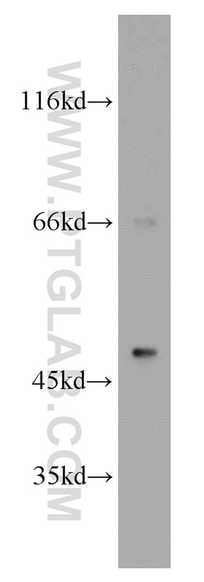 B3GALT2 Antibody in Western Blot (WB)