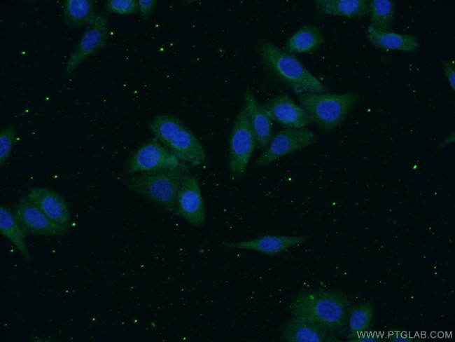 alpha-1B-glycoprotein Antibody in Immunocytochemistry (ICC/IF)