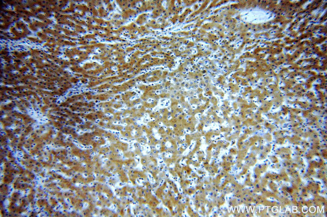 alpha-1B-glycoprotein Antibody in Immunohistochemistry (Paraffin) (IHC (P))