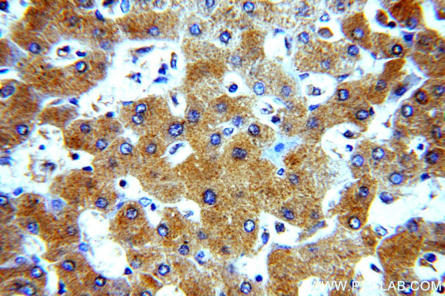 alpha-1B-glycoprotein Antibody in Immunohistochemistry (Paraffin) (IHC (P))