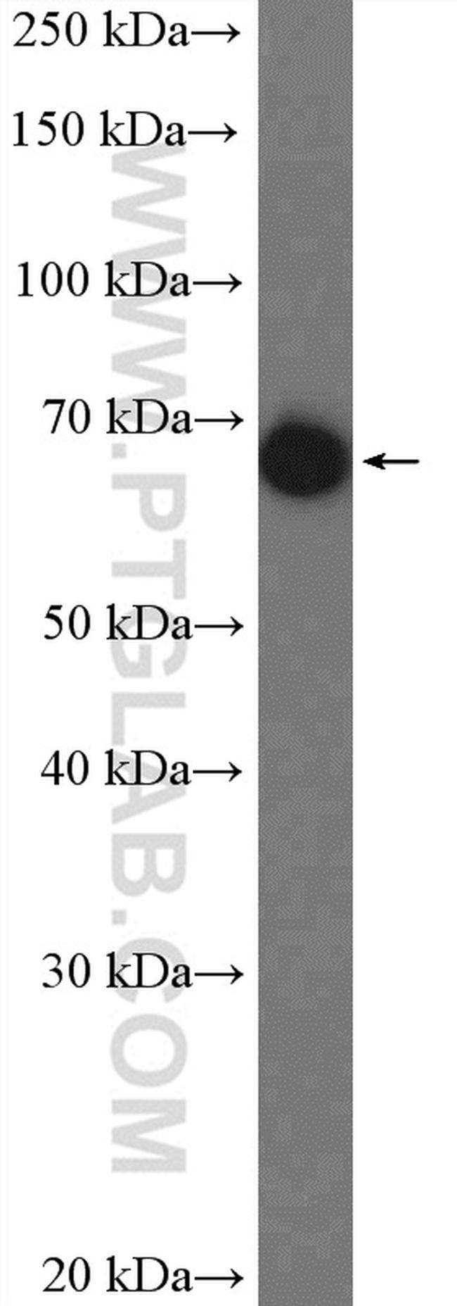 alpha-1B-glycoprotein Antibody in Western Blot (WB)