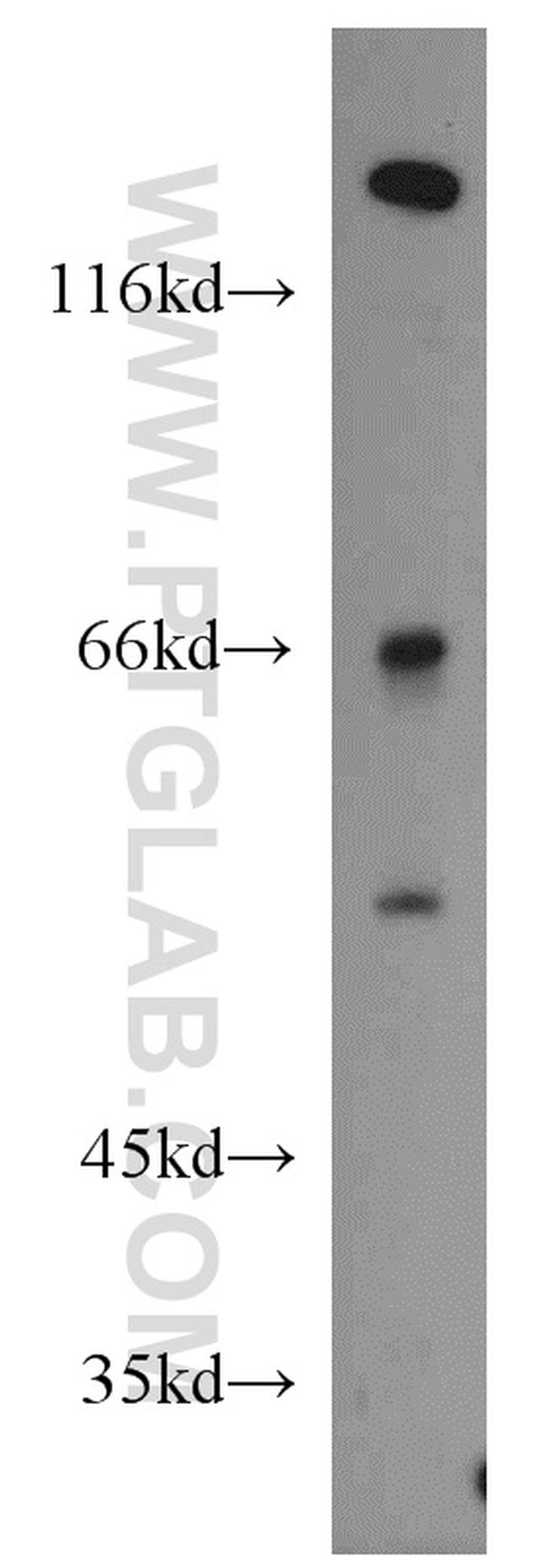 alpha-1B-glycoprotein Antibody in Western Blot (WB)