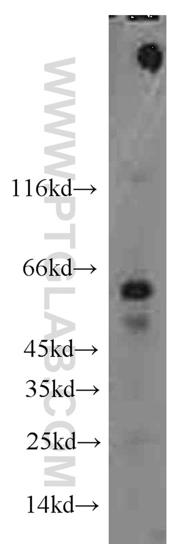 alpha-1B-glycoprotein Antibody in Western Blot (WB)