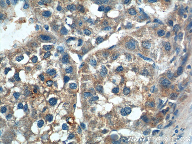 SGSH Antibody in Immunohistochemistry (Paraffin) (IHC (P))