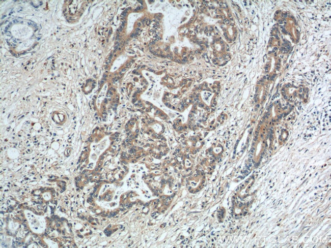 SGSH Antibody in Immunohistochemistry (Paraffin) (IHC (P))