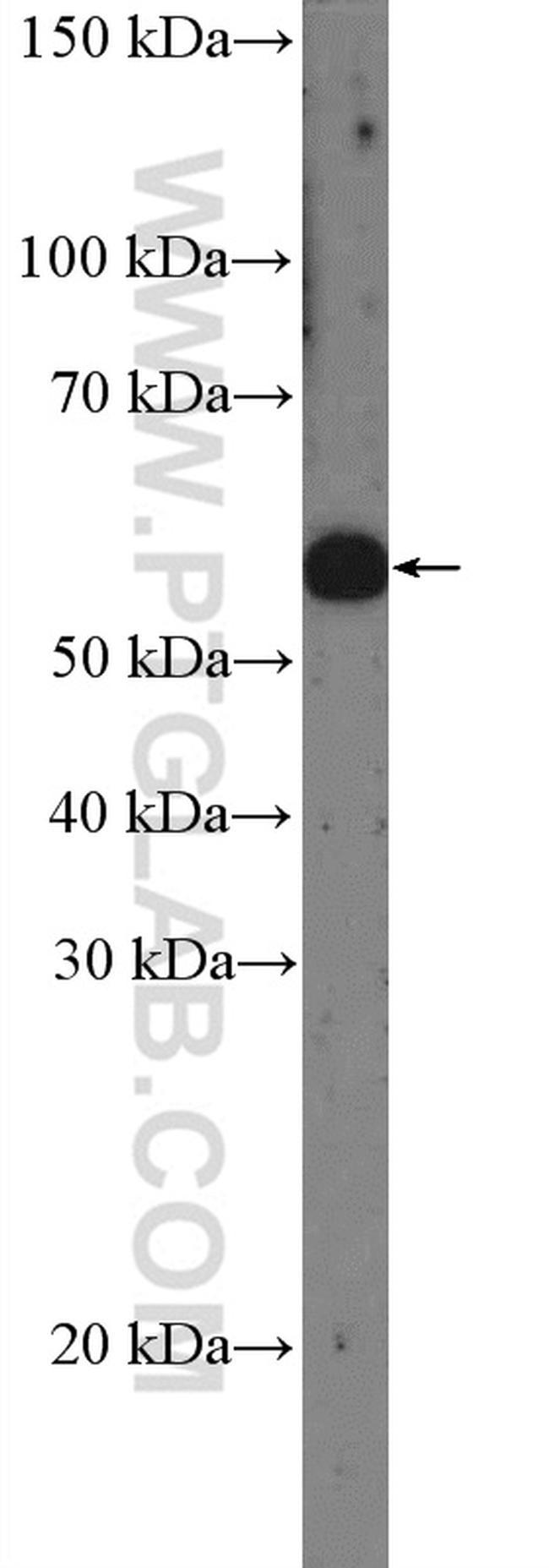 SGSH Antibody in Western Blot (WB)