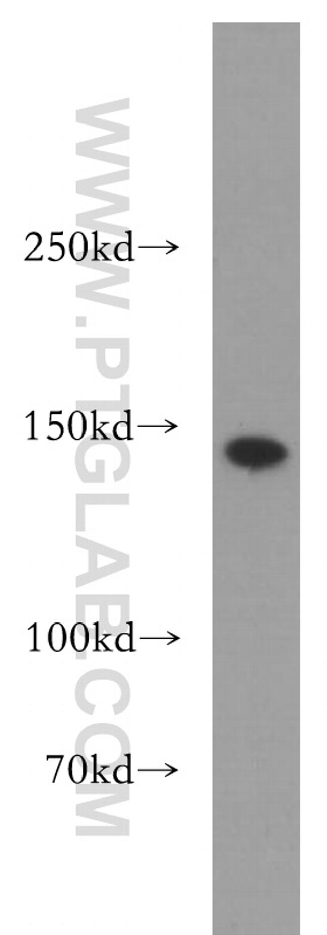 SMC3 Antibody in Western Blot (WB)