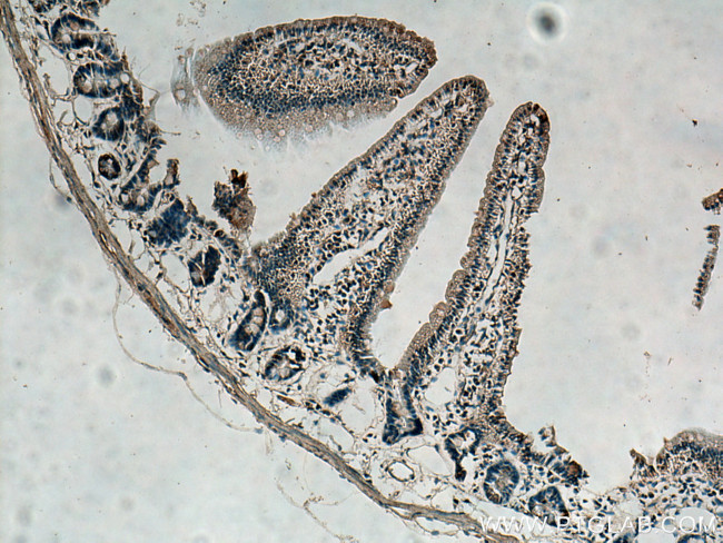 UPP1 Antibody in Immunohistochemistry (Paraffin) (IHC (P))