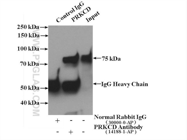 PKC delta Antibody in Immunoprecipitation (IP)