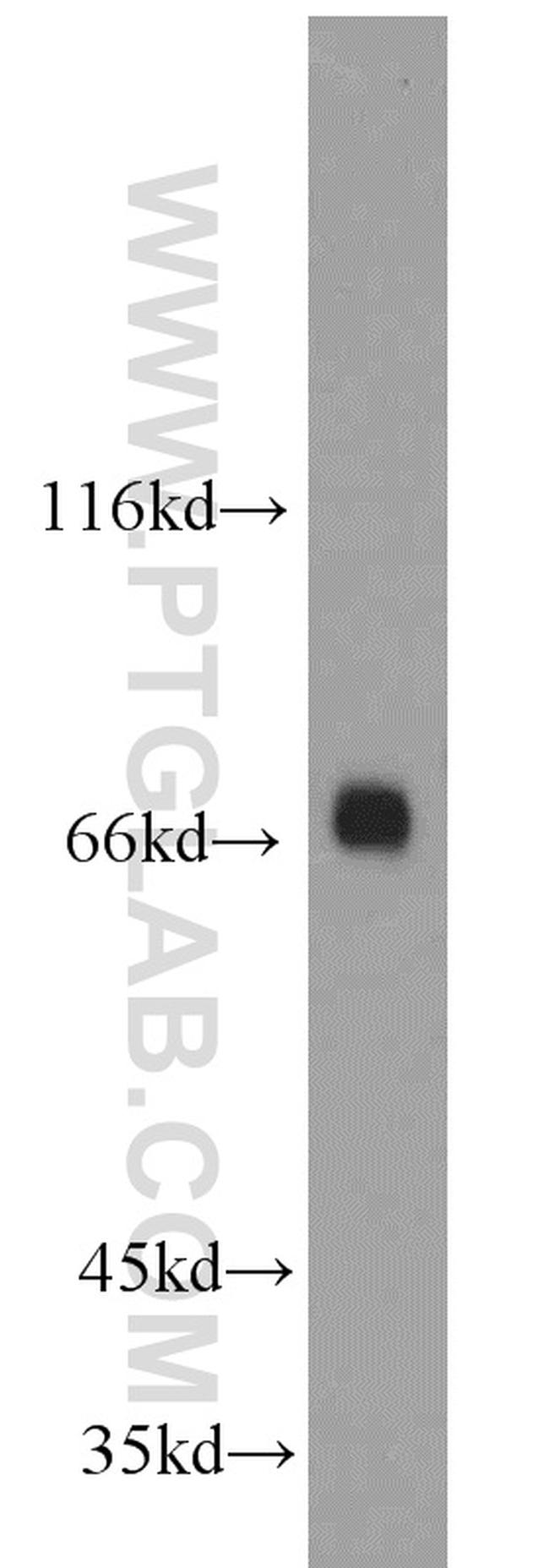 PKC delta Antibody in Western Blot (WB)