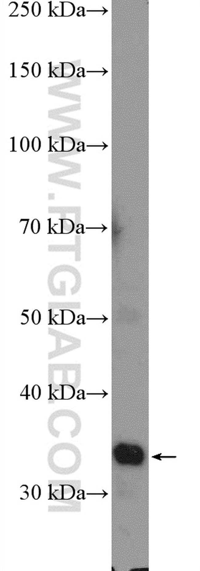 PPP1R3B Antibody in Western Blot (WB)