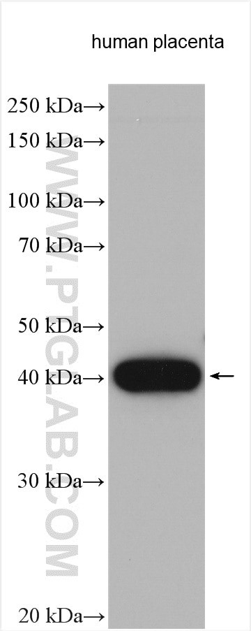 HSD11B2 Antibody in Western Blot (WB)