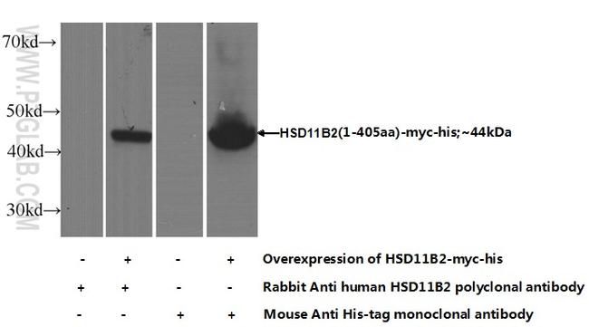 HSD11B2 Antibody in Western Blot (WB)