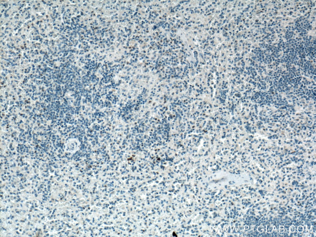 TNFSF14 Antibody in Immunohistochemistry (Paraffin) (IHC (P))