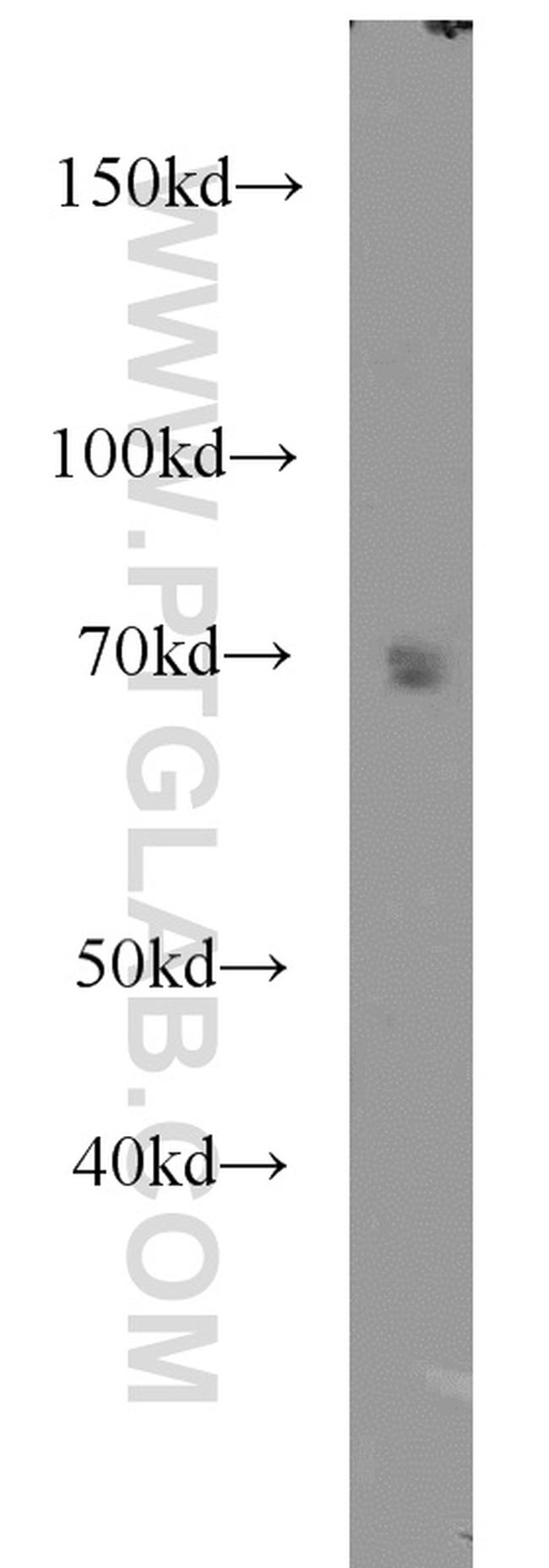 CAT-1 Antibody in Western Blot (WB)