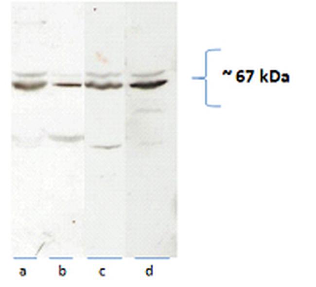 CAT-1 Antibody in Western Blot (WB)