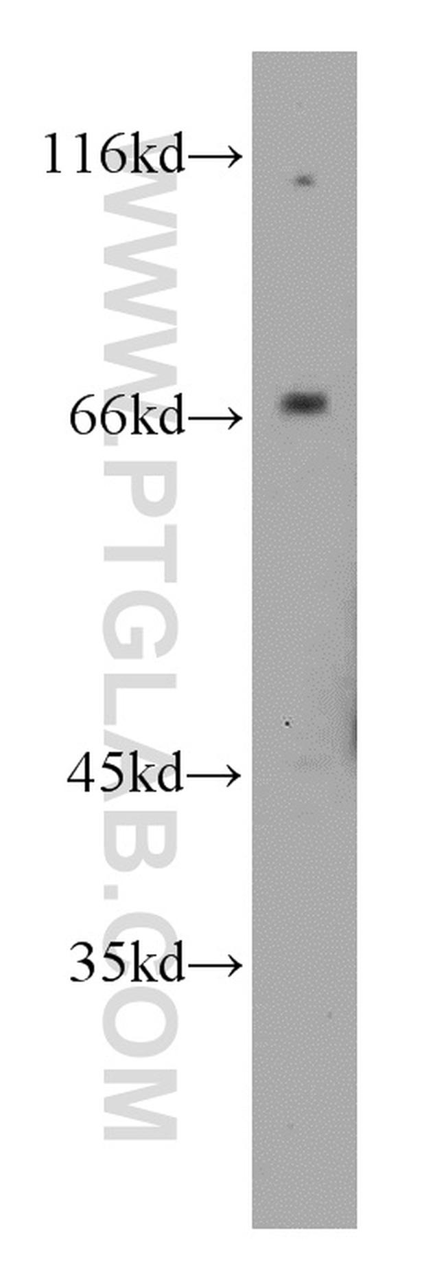 CAT-1 Antibody in Western Blot (WB)