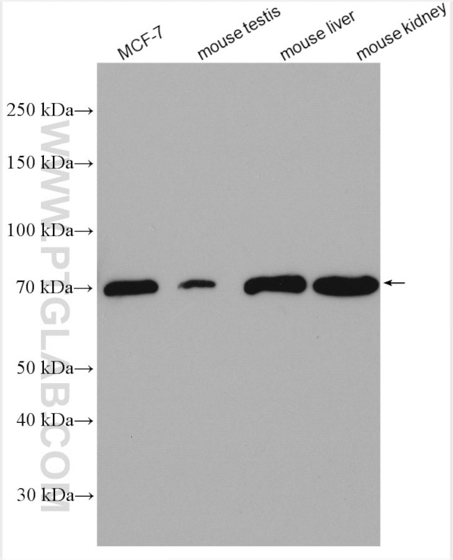 SLC27A6 Antibody in Western Blot (WB)