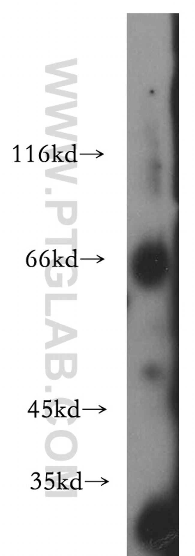 GFI1 Antibody in Western Blot (WB)