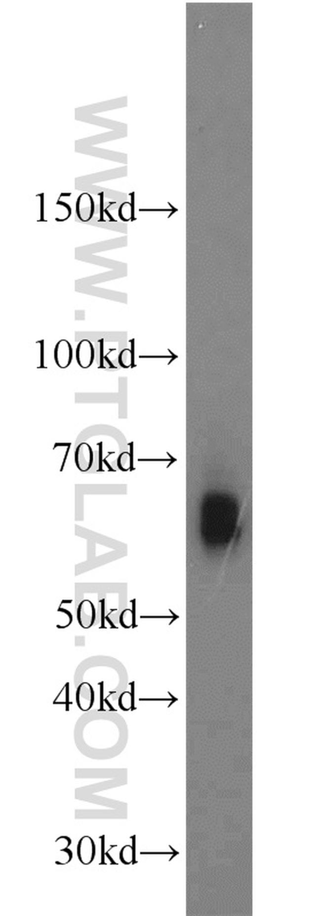 GFI1 Antibody in Western Blot (WB)