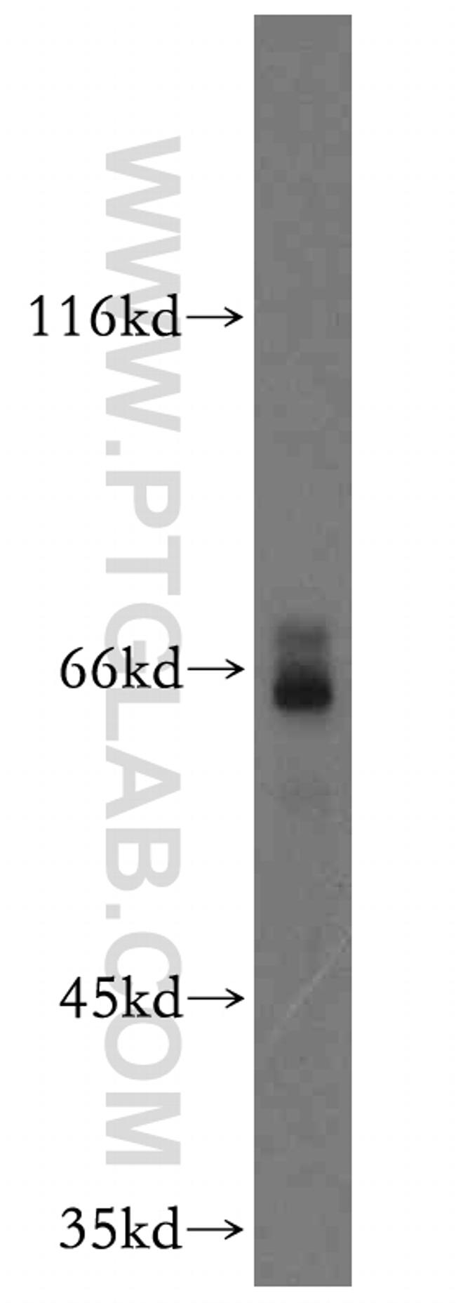 GFI1 Antibody in Western Blot (WB)