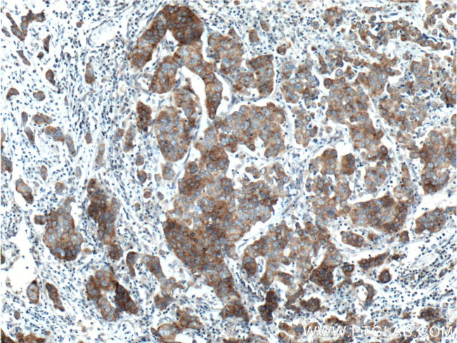 TNK1 Antibody in Immunohistochemistry (Paraffin) (IHC (P))