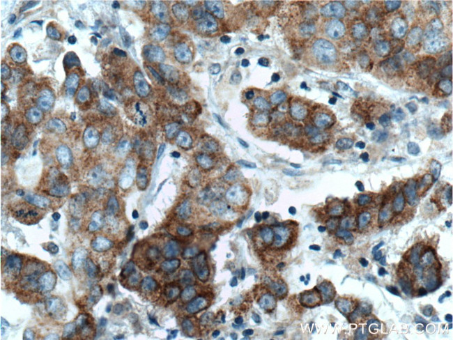 TNK1 Antibody in Immunohistochemistry (Paraffin) (IHC (P))