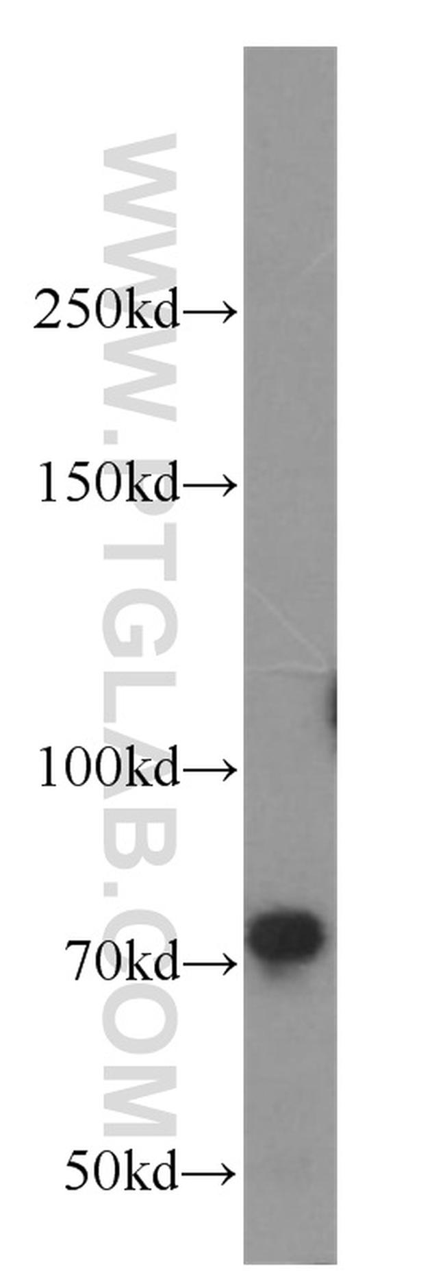 TNK1 Antibody in Western Blot (WB)