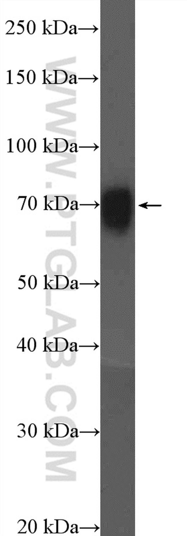 CSTF2T Antibody in Western Blot (WB)