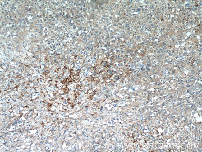 PIWIL2 Antibody in Immunohistochemistry (Paraffin) (IHC (P))