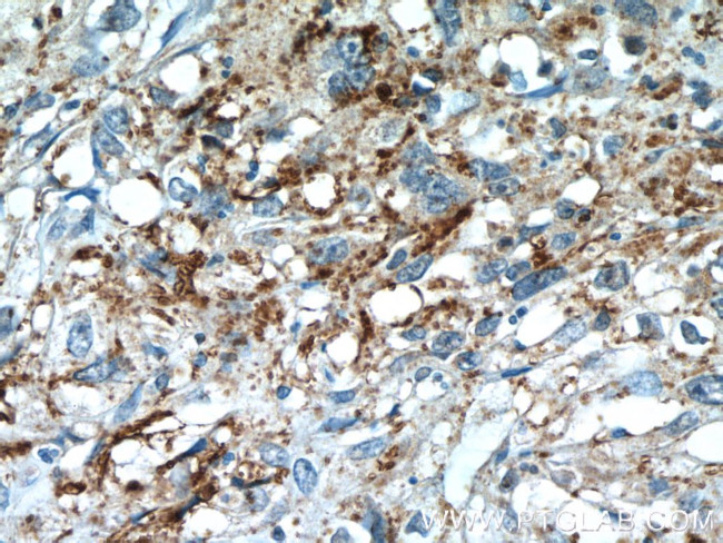 PIWIL2 Antibody in Immunohistochemistry (Paraffin) (IHC (P))