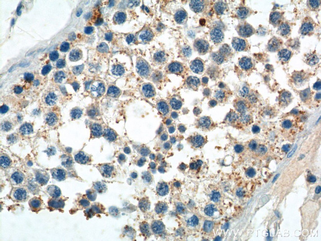 PIWIL2 Antibody in Immunohistochemistry (Paraffin) (IHC (P))