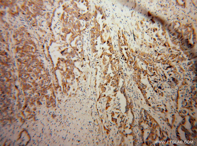 KChIP1 Antibody in Immunohistochemistry (Paraffin) (IHC (P))