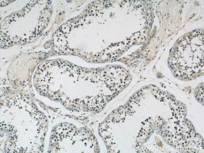 MTIF3 Antibody in Immunohistochemistry (Paraffin) (IHC (P))