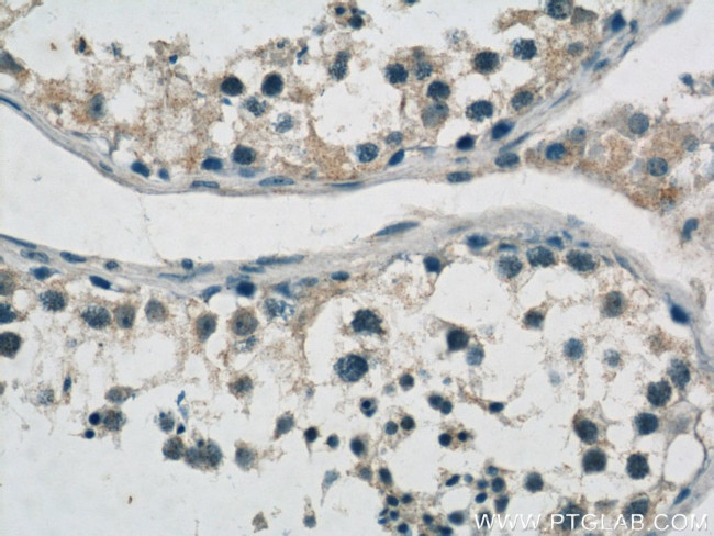 MTIF3 Antibody in Immunohistochemistry (Paraffin) (IHC (P))