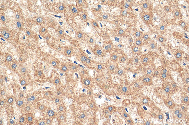 MTIF3 Antibody in Immunohistochemistry (Paraffin) (IHC (P))