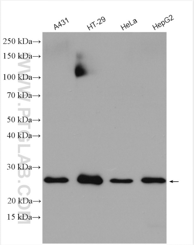 MTIF3 Antibody in Western Blot (WB)