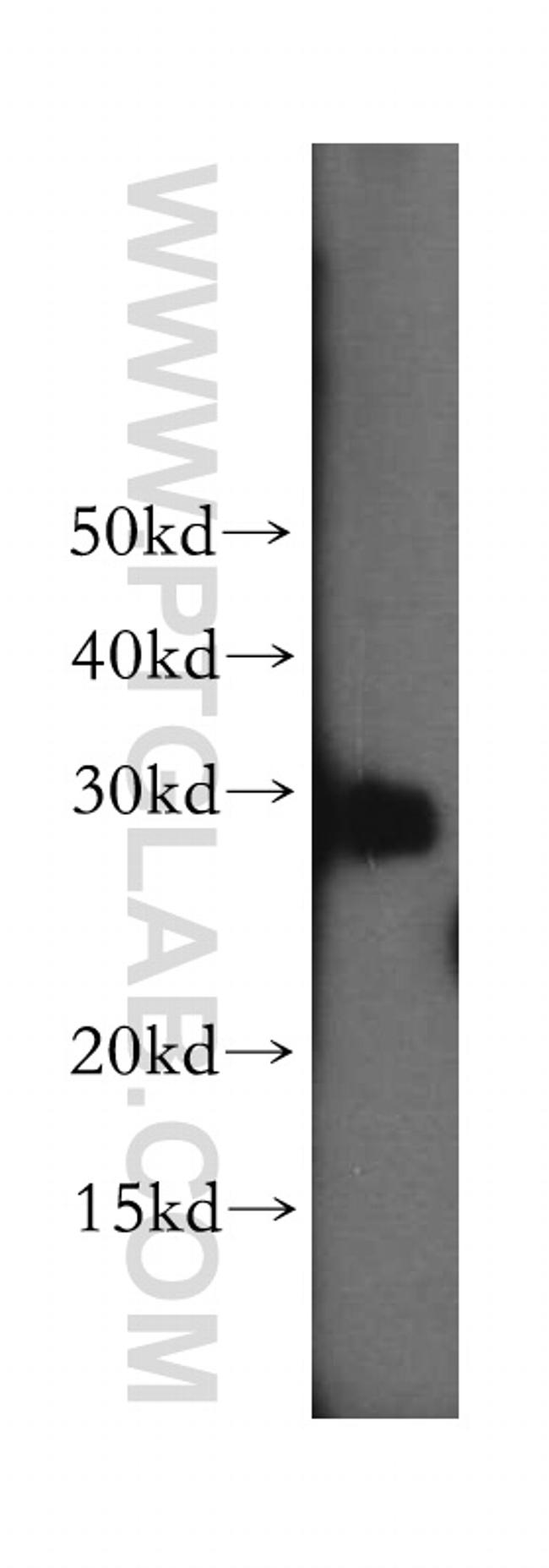 MTIF3 Antibody in Western Blot (WB)