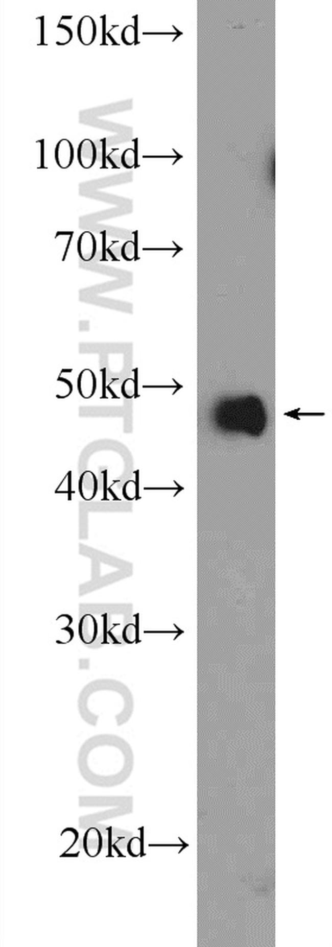 NFKB1 p105/p50 Antibody in Western Blot (WB)