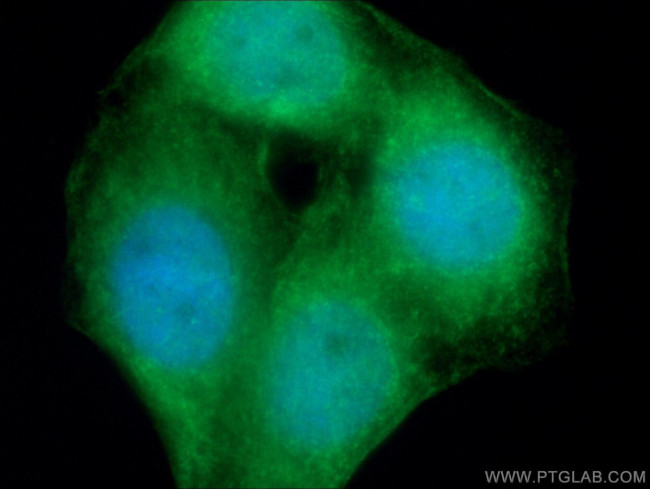 NFKB1 p105/p50 Antibody in Immunocytochemistry (ICC/IF)