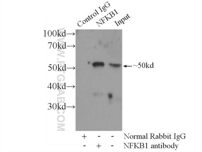 NFKB1 p105/p50 Antibody in Immunoprecipitation (IP)